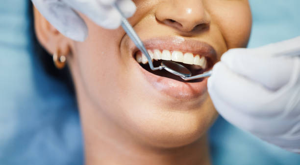 Best Emergency Cosmetic Dentistry (e.g., broken veneers) in Swanton, OH